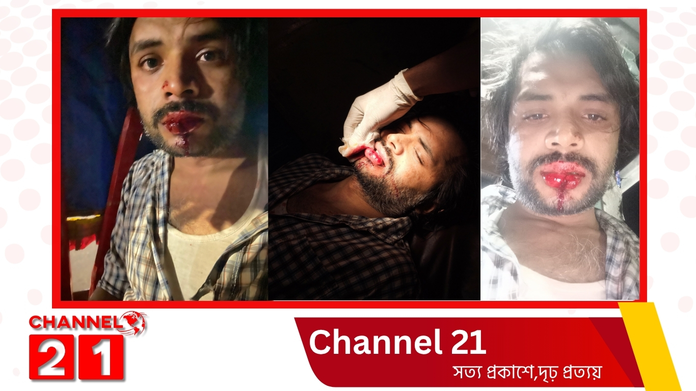 গাবতলীতে কিশোর গ্যাংয়ের সন্ত্রাসী হামলায় আহত ব্যবসায়ী, থানায় অভিযোগের পর আত্মীয়দের উপর পাল্টা হামলা