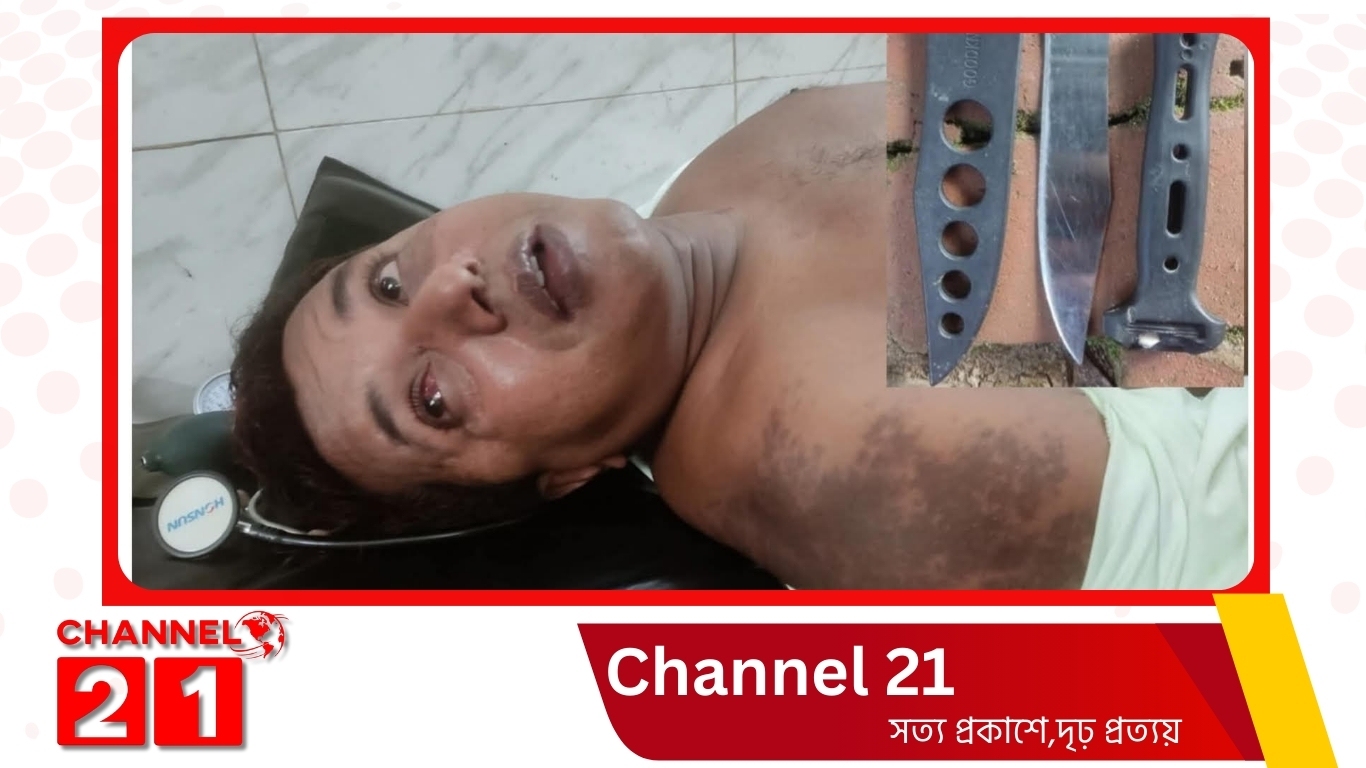 নরসিংদীর মনোহরদীতে প্রাথমিক বিদ্যালয়ের শিক্ষককে ছুরিকাঘাত ও মারধর।