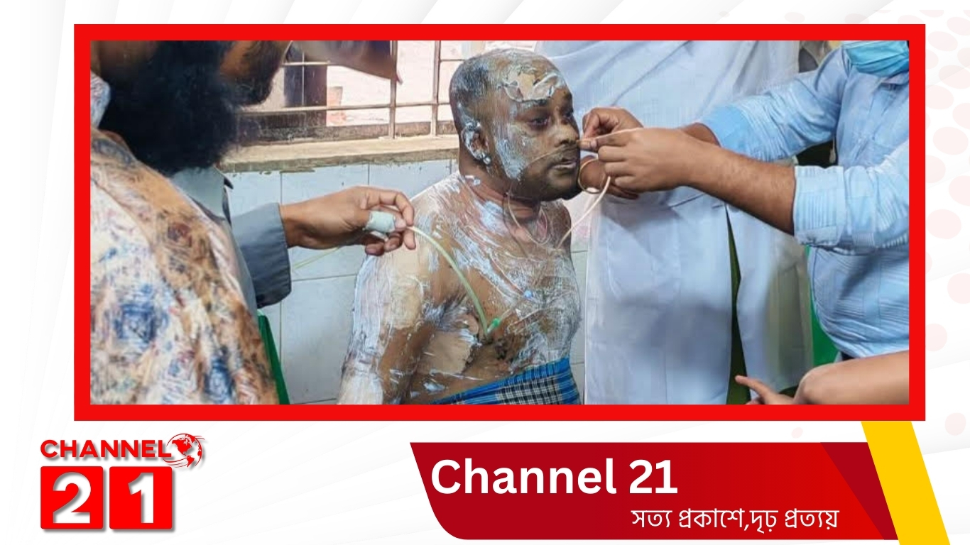 নেত্রকোণায় দোকানে এসি বিস্ফোরণের  আগুনে ব্যবসায়ী দগ্ধ